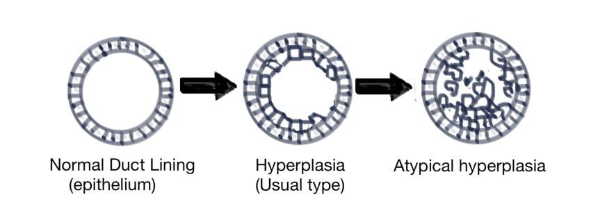 Atypia
