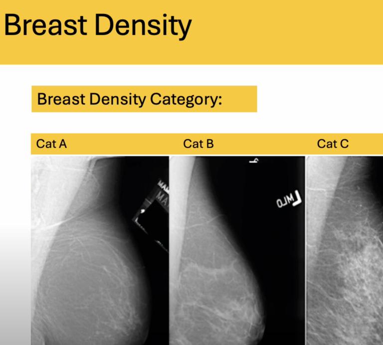 Dr Daniel de Viana Presents on Breast Density